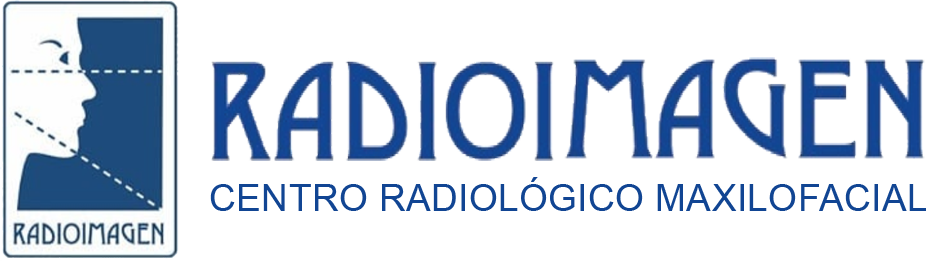 Radioimagen